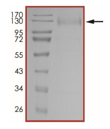 The purity of nCoV-S1 (A222V, D614G) was determined to be >90% by densitometry